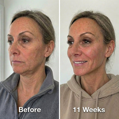 Face Collagen Sculpt Wrap