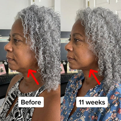 Collagen Face Sculpt Wrap (Buy 1 Get 1 FREE)